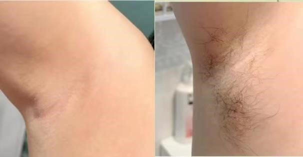 Smooth Skin Hair Inhibitor Spray