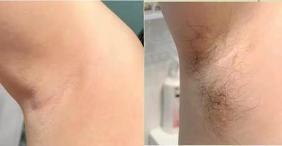 Smooth Skin Hair Inhibitor Spray