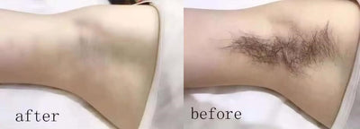 Smooth Skin Hair Inhibitor Spray