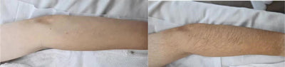 Smooth Skin Hair Inhibitor Spray