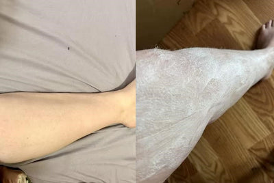 Smooth Skin Hair Inhibitor Spray