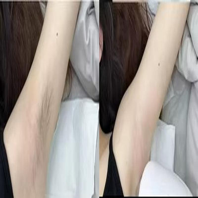 Smooth Skin Hair Inhibitor Spray