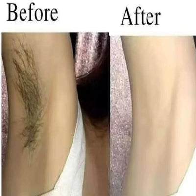 Smooth Skin Hair Inhibitor Spray