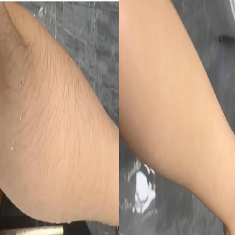 Smooth Skin Hair Inhibitor Spray