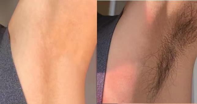 Smooth Skin Hair Inhibitor Spray